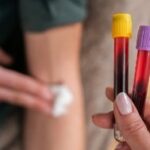Thuisverpleging Voetzorg SaCura Sanne Jeunen zelfstandig thuisverpleegkundige Limburg regio Lanaken Genk Zutendaal thuiszorg thuisverpleegkundige thuisverpleegster verpleegster aan huis wondzorg palliatieve thuiszorg windels aandoen steunkousen aandoen medicatie klaarzetten medicatiebeheer wassen aankleden helpen met een bad of douche nemen helpen met aankleden dagelijkse hygiëne nagels knippen scheren bloedname bloednames bloed afnemen stomazorg verzorgen van stoma postoperatieve thuiszorg zorg na operaties inspuitingen wondzorg infuustherapie en sondevoeding voetzorg pedicure aan huis eksterogen eelt mycose nagelcorrectie nagelregulatie wrat frezen nagelbeugel nagels knippen