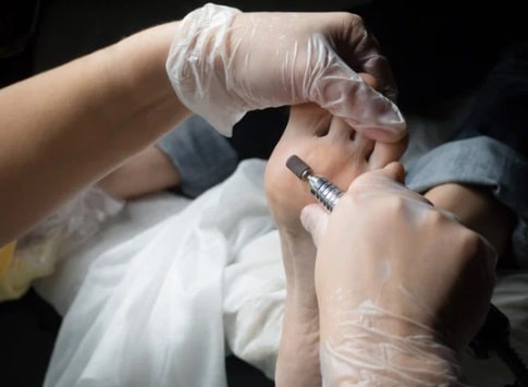 Medische pedicure lanaken