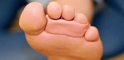 pedicure genk